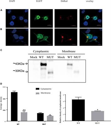 Functional analysis of a novel nonsense variant c.91A>T of the TRAPPC2 gene in a Chinese family with X-linked recessive autosomal spondyloepiphyseal dysplasia tarda